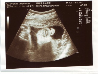 Munchkin 32 weeks